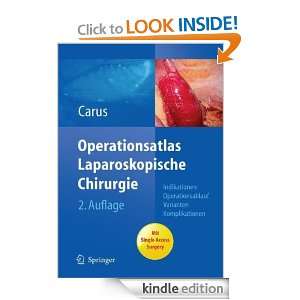   Access Surgery (German Edition) Thomas Carus  Kindle
