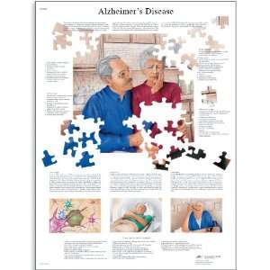  3B Scientific VR1628UU Glossy Paper Alzheimers Disease 