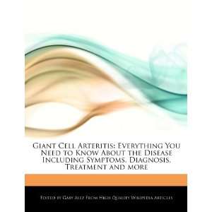  Giant Cell Arteritis Everything You Need to Know About 
