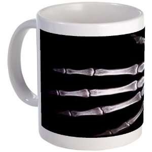  Hand X Ray Medical Mug by CafePress: Kitchen & Dining