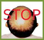   LOSS SHAMPOO for HAIR GROWTH & DANDRUFF TREATMENT *** (TRIED & TESTED